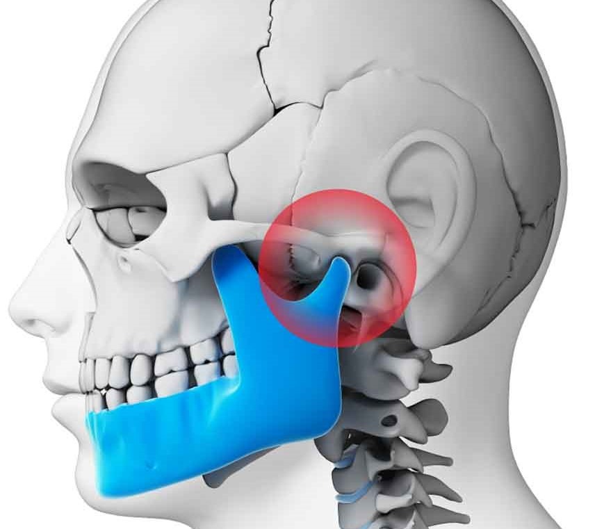 How to Stop Headaches Caused by Your Teeth How to Stop Headaches Caused by Your Teeth